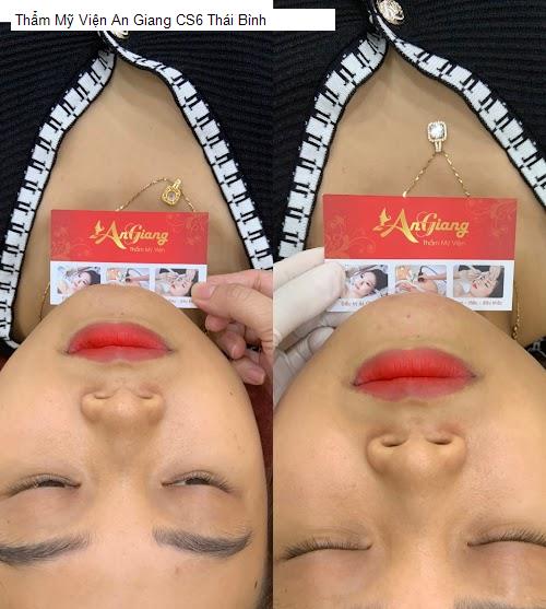 Hình ảnh Thẩm Mỹ Viện An Giang CS6 Thái Bình