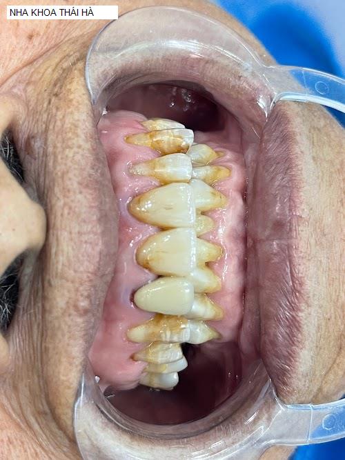 Hình ảnh NHA KHOA THÁI HÀ