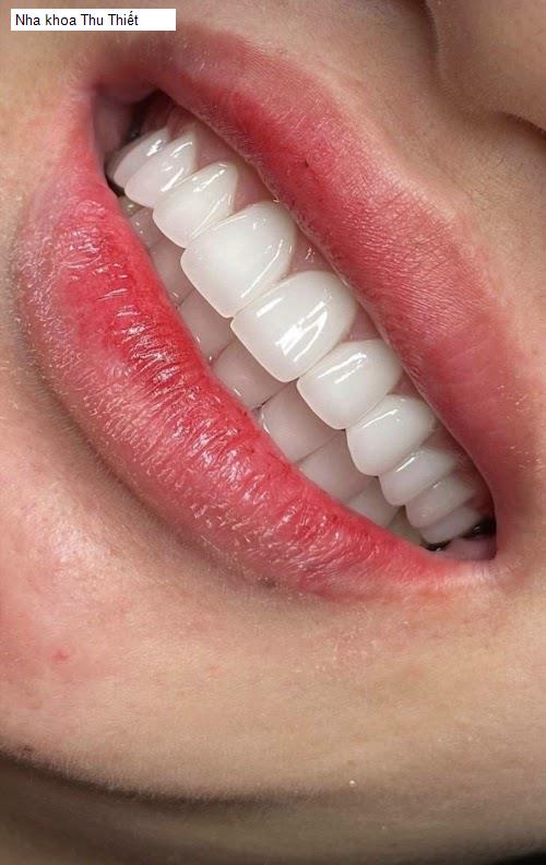 Hình ảnh Nha khoa Thu Thiết