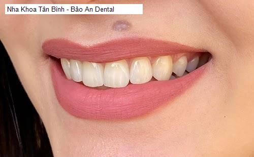 Hình ảnh Nha Khoa Tân Bình - Bảo An Dental